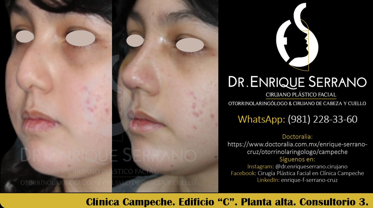 Enrique Serrano Cruz-66