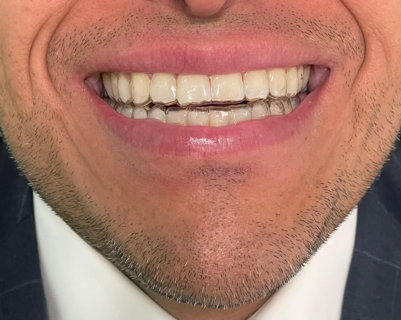 Anuar Becerril Castro-1