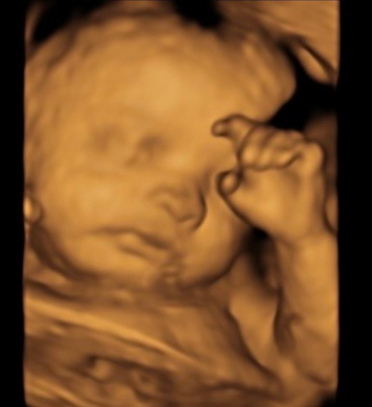 Zabdy Shirel H. Lascurain-13