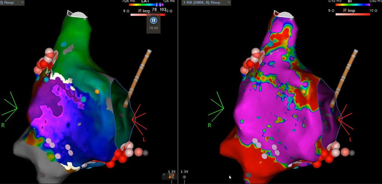 Elias Terrazas Cervantes-1