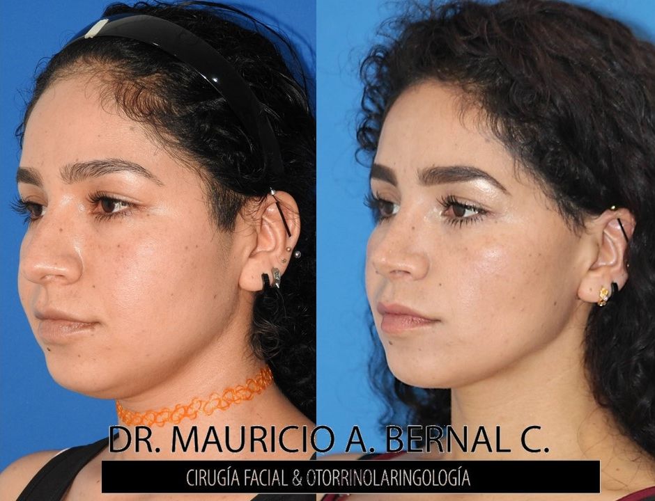 Mauricio Alejandro Bernal Carreon-3