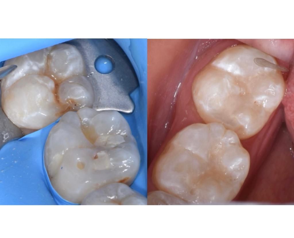 Andrea Moncada Rmz-13