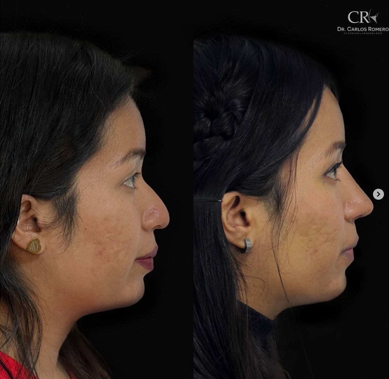 Carlos Alfonso Romero Gameros-18