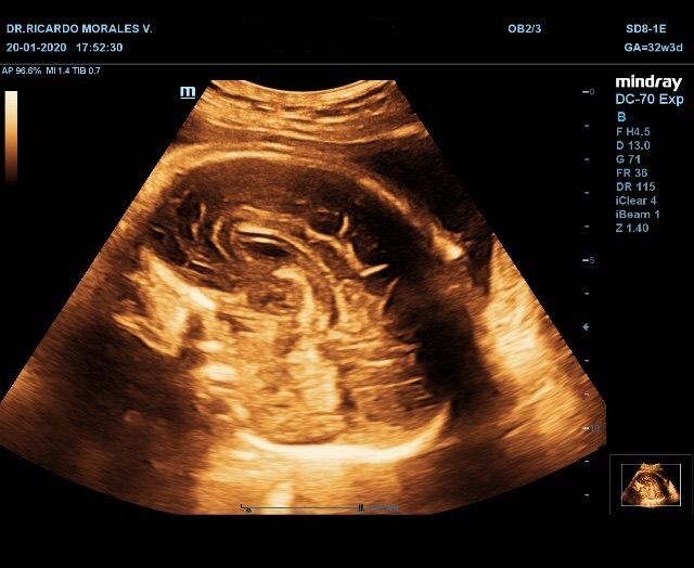 Ricardo Morales Velázquez-9