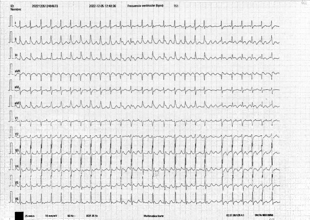 Erick Salvador Olmedo Villa-10
