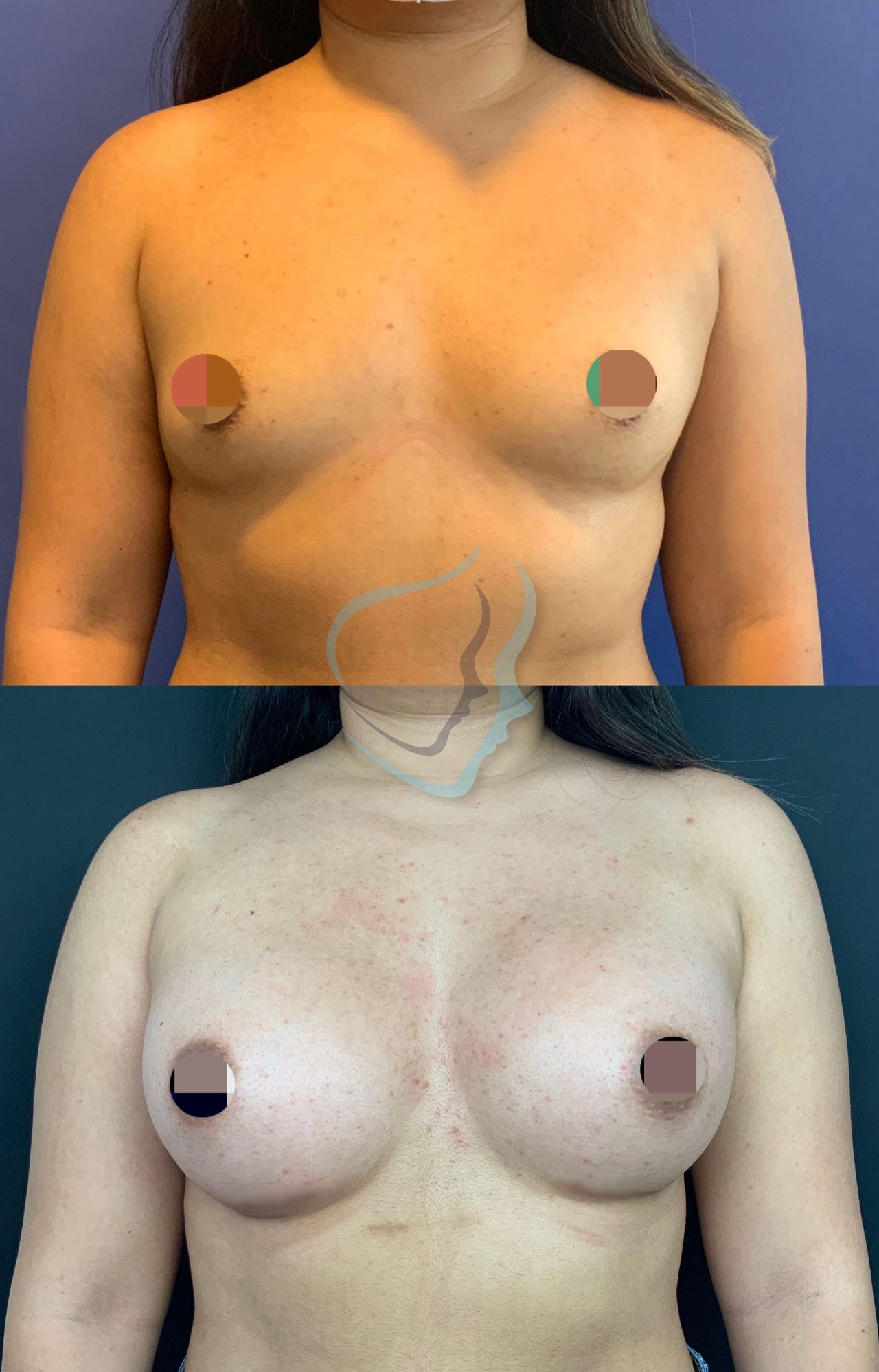 Giuseppe Tanzillo-44