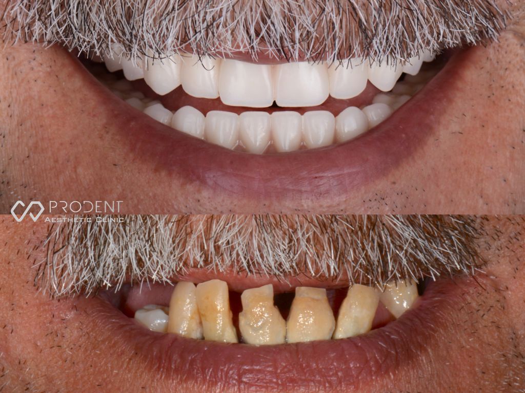 Ramiro Ivan Pérez Murillo-22