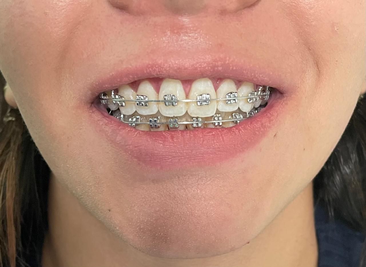 Anuar Becerril Castro-13