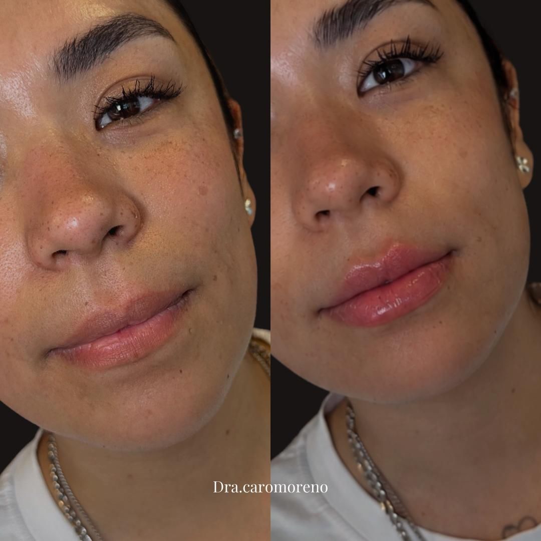 Carolina Moreno-0