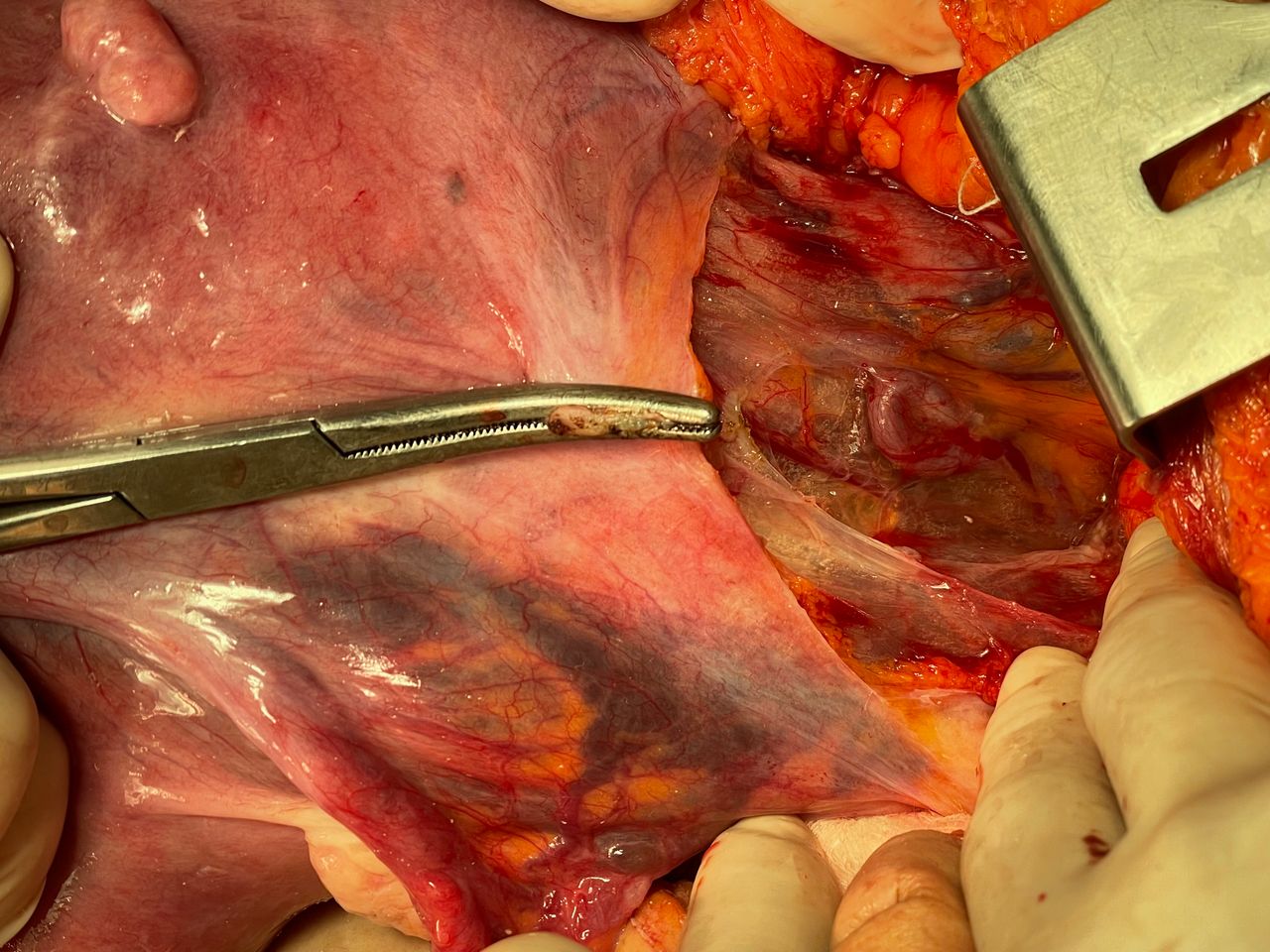 Gonzalo Hernández Martínez-29