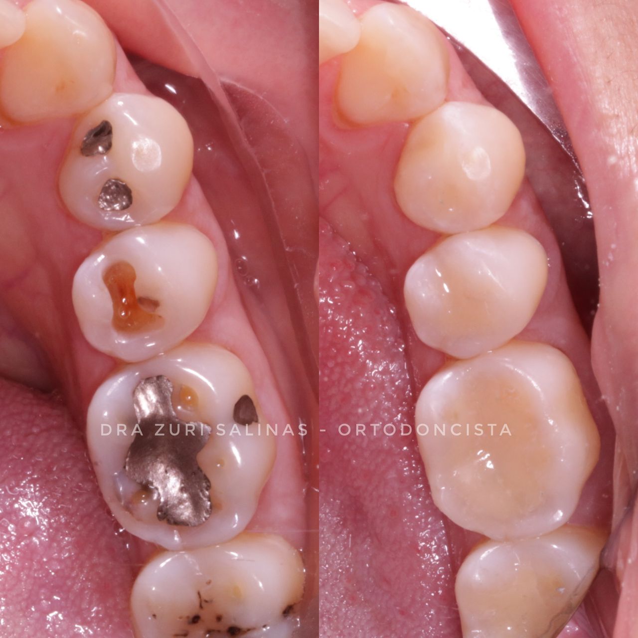 Zurisadai Salinas Chávez-1