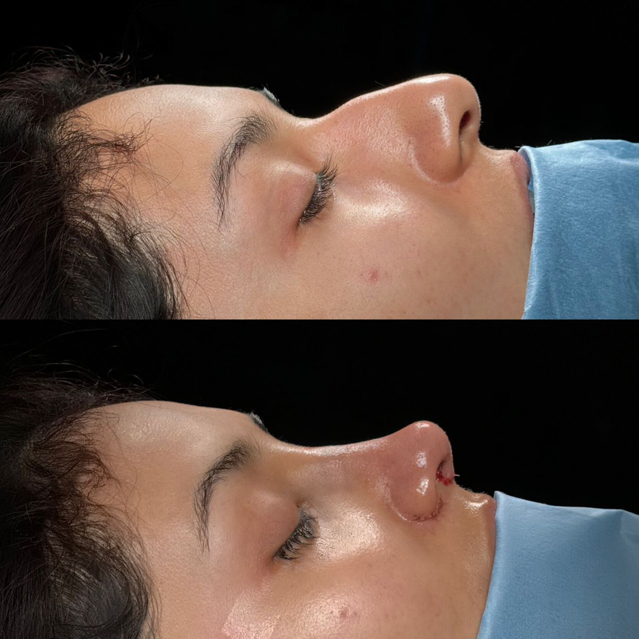 Angel Castro Urquizo-94