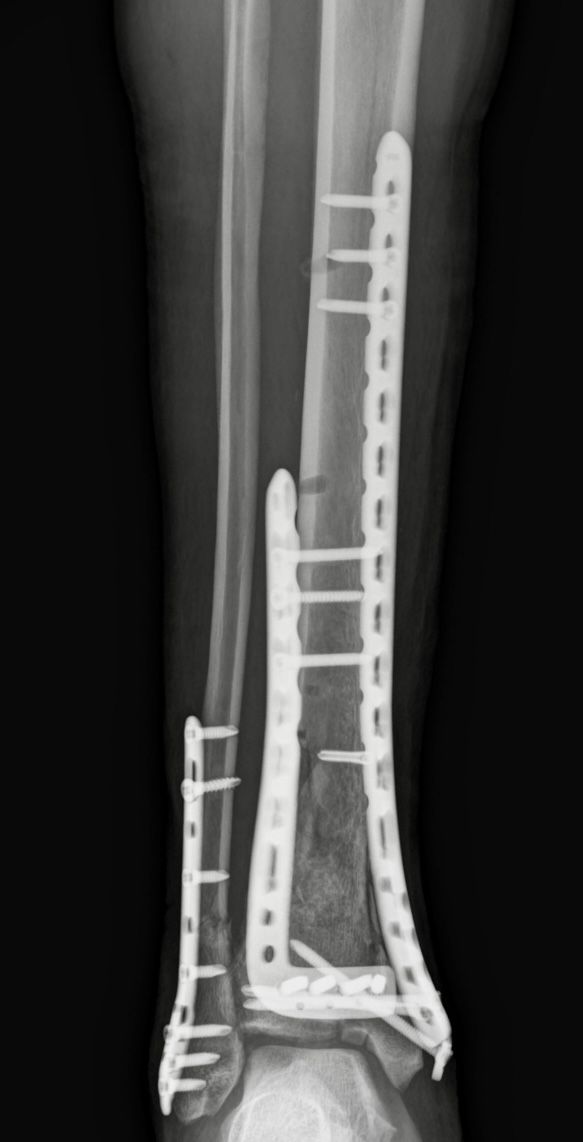 Jorge Barcenas Hernandez-1