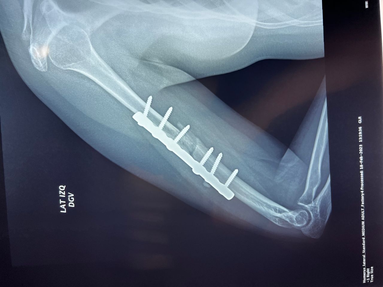 Luis Alberto Monge Bravo-11