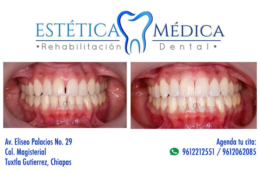 Bielmy Veronica Jonapa Peña-39