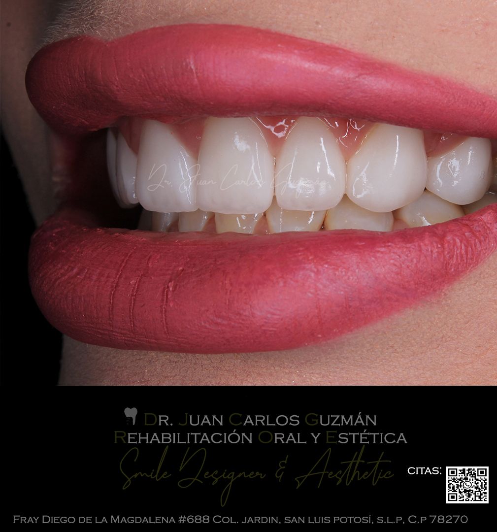 Juan Carlos Guzmán Castañeda-26