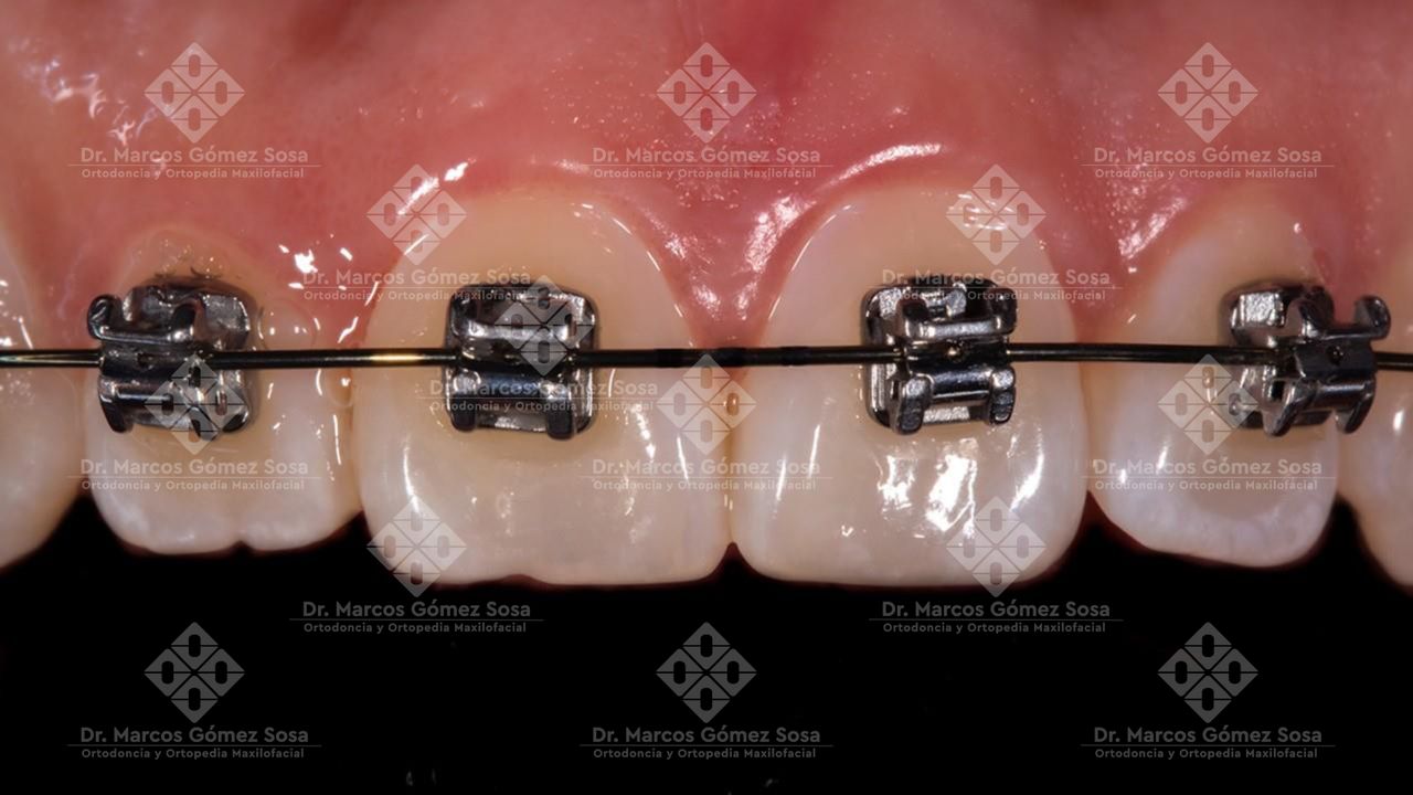 Marcos Gómez Sosa-10