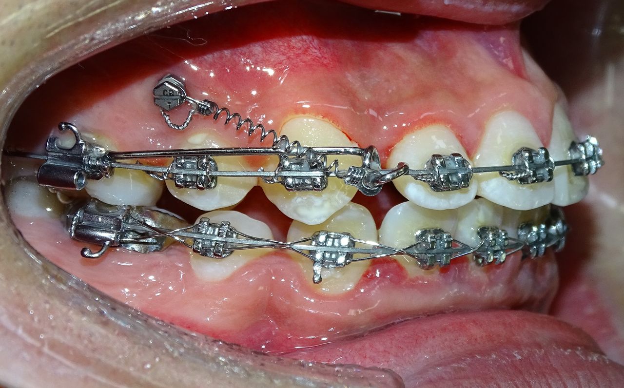 Marianela Tenorio-10