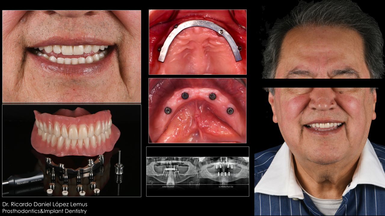 Ricardo López Lemus-57