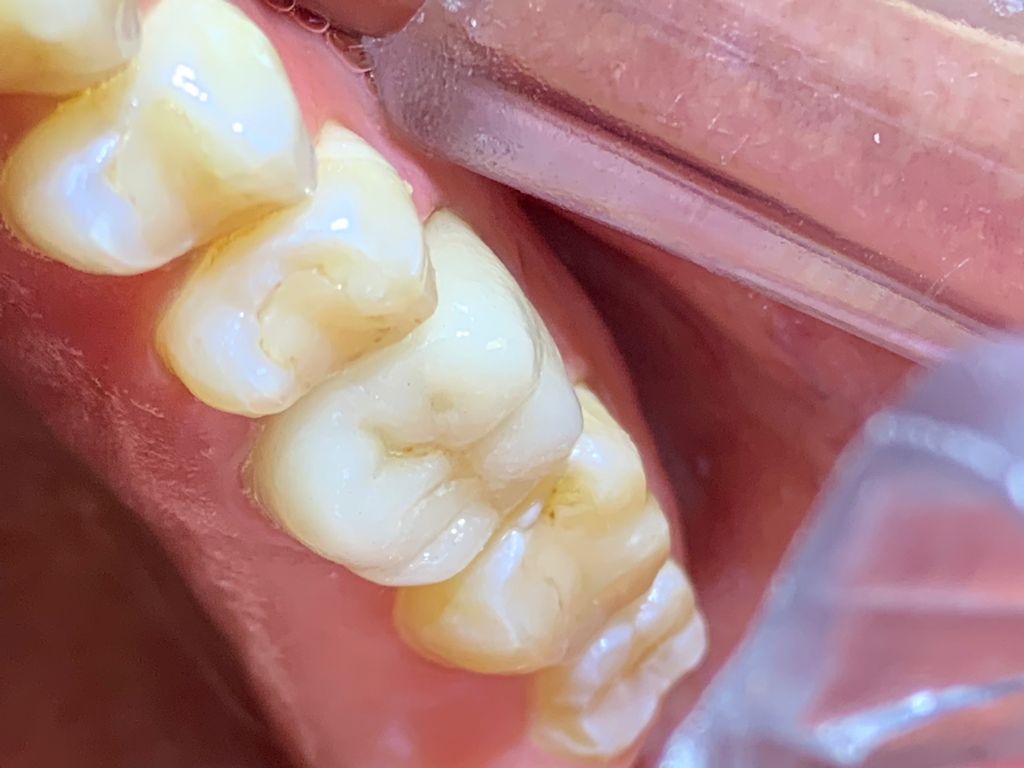 Yuriria Gochy Escalante-8