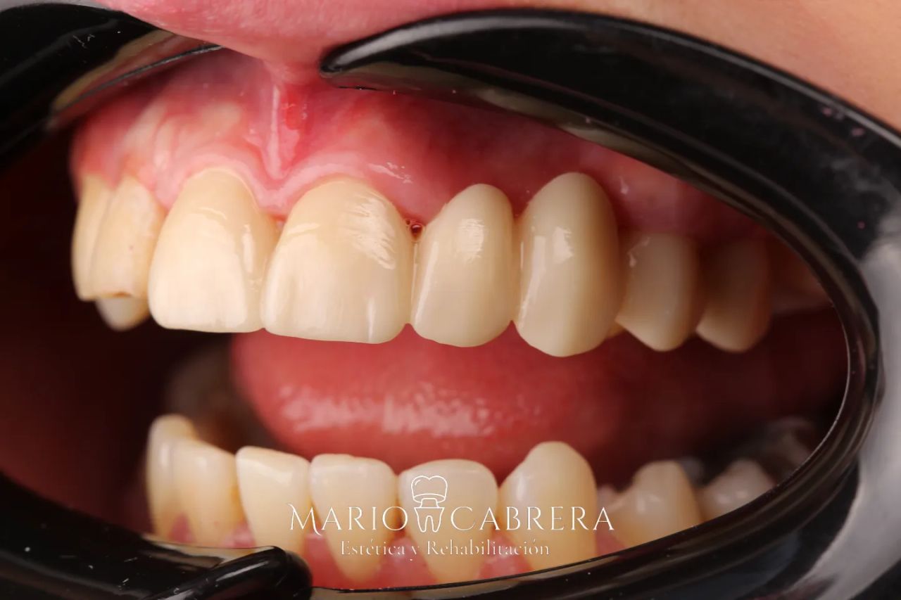 Mario Francisco Cabrera Ballona-6