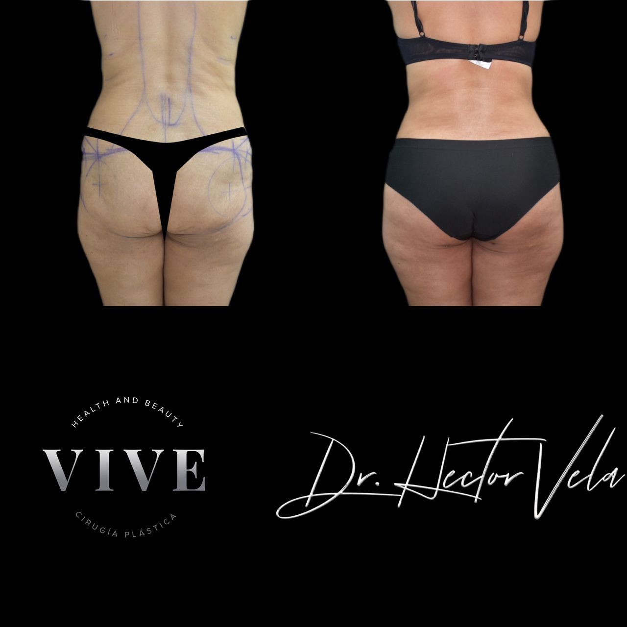 Héctor Eduardo Vela Cardona-212