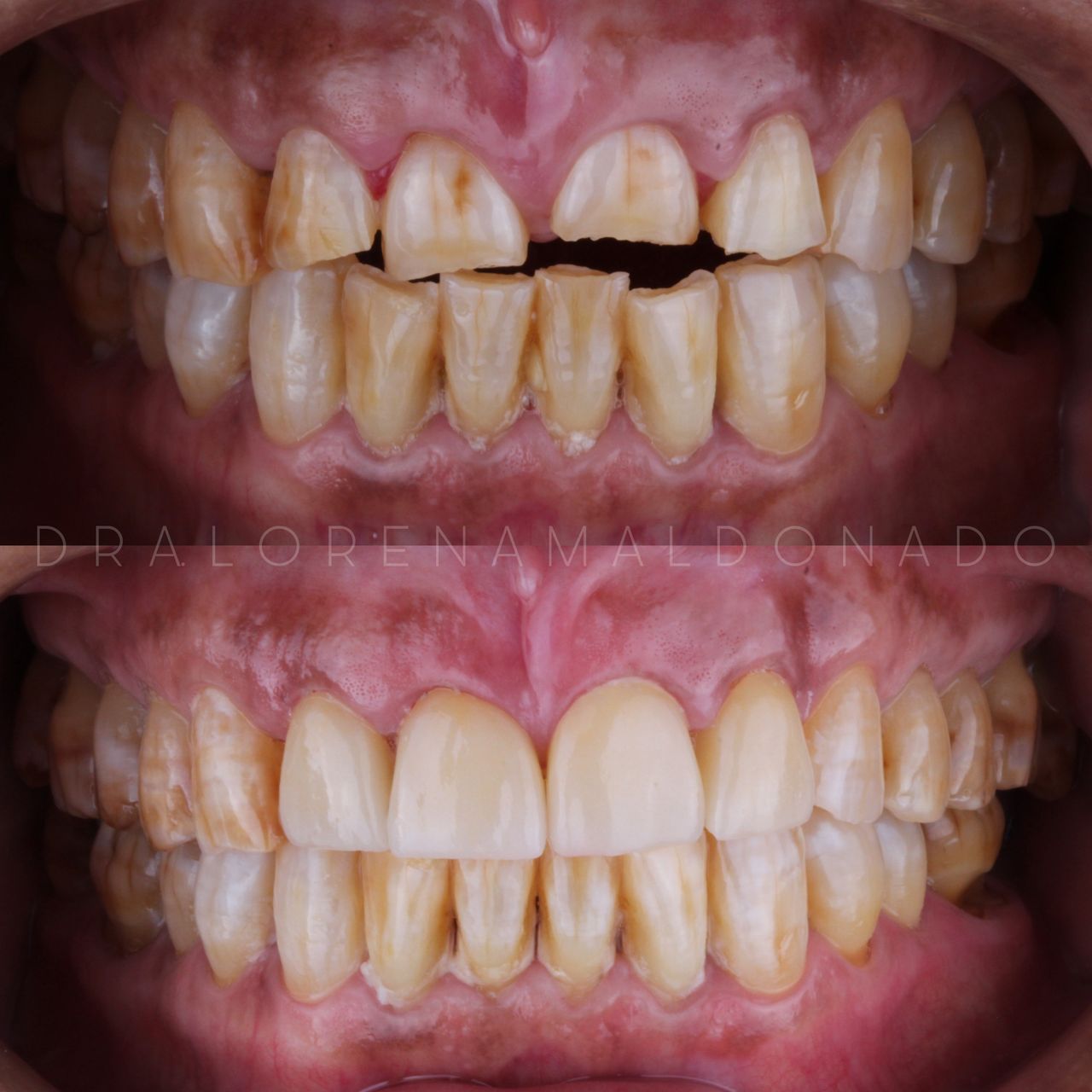 Ana Lorena Maldonado Munguia-14