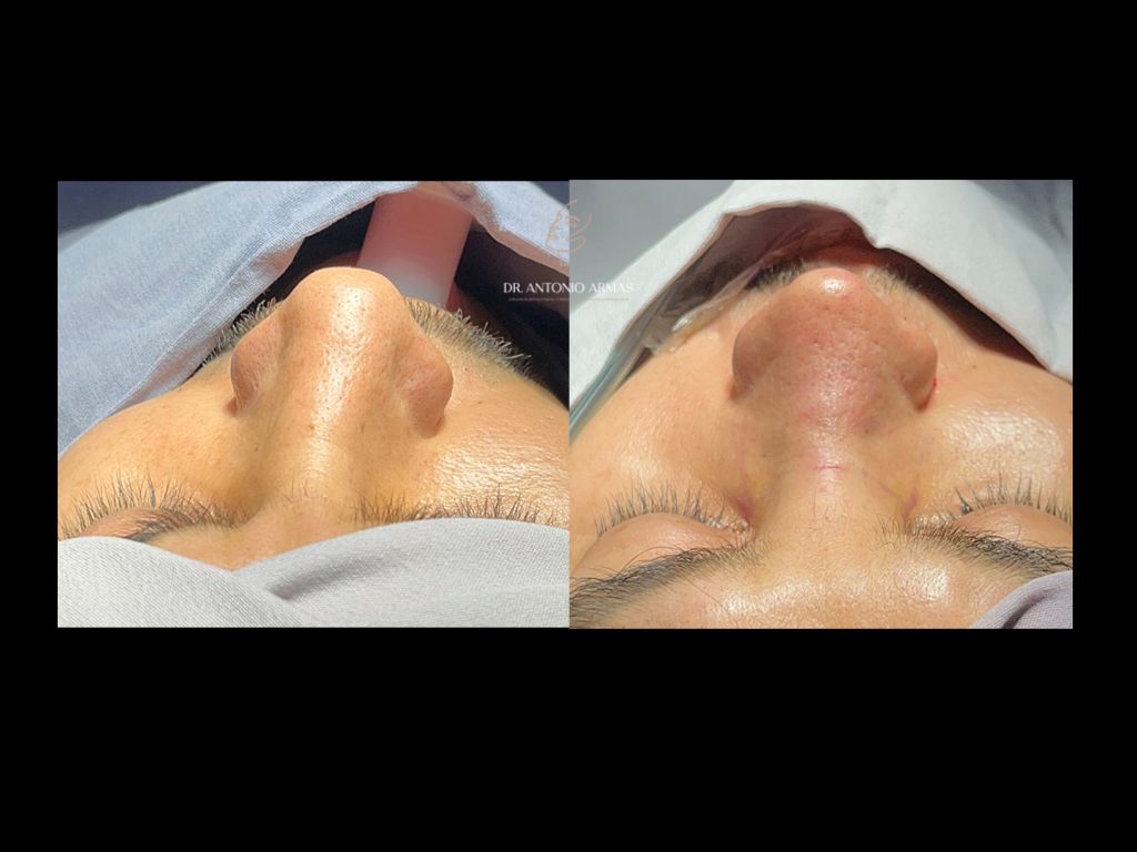 Juan Antonio González Armas-4