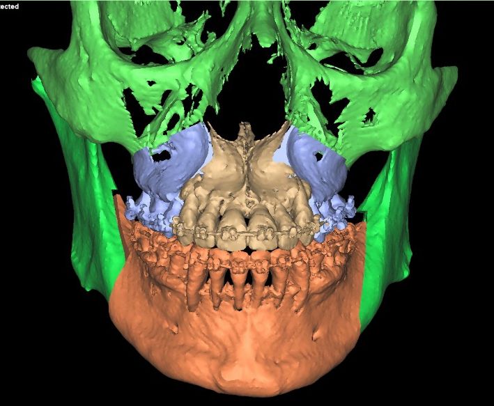 Christian San Juan González-19