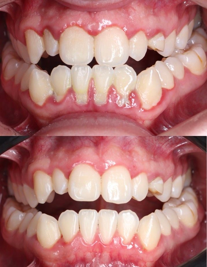 Francisco Galeana Araujo-2