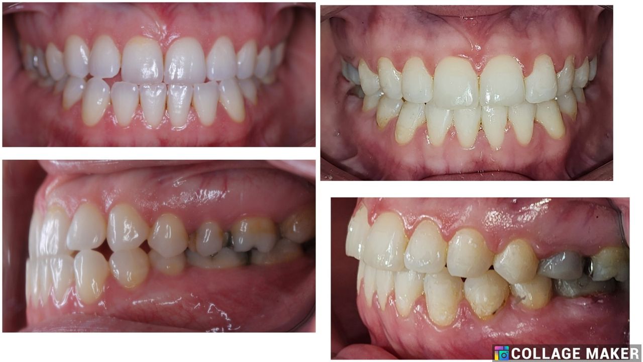 Ryan Michael Brenes Pacheco-15