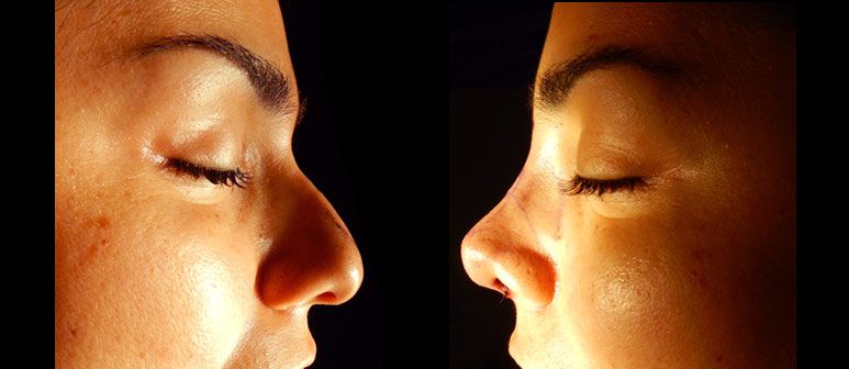 Edgar Ernesto Torres Mejía-38