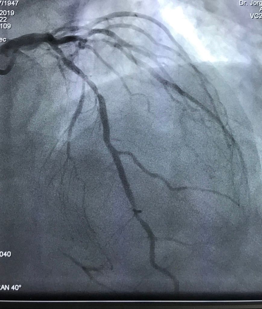 Jorge Lizarraga Sanchez-3