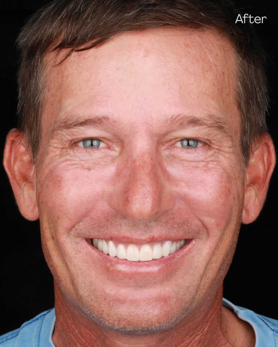 Diana Chacon Cervera-10