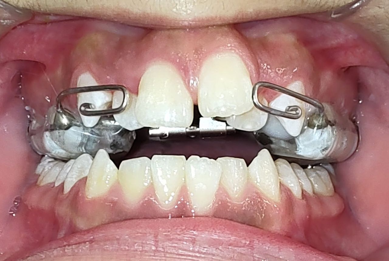 Aimée Quiroz Mendoza-20