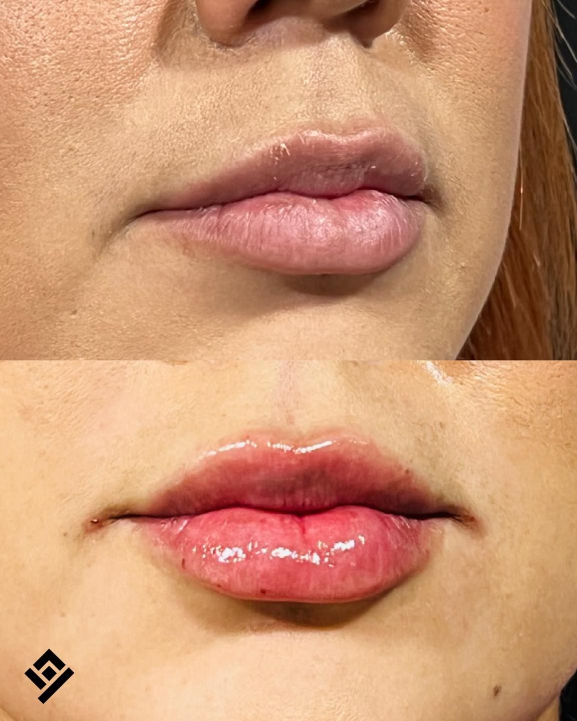 Yves Aguilar Fernández-6