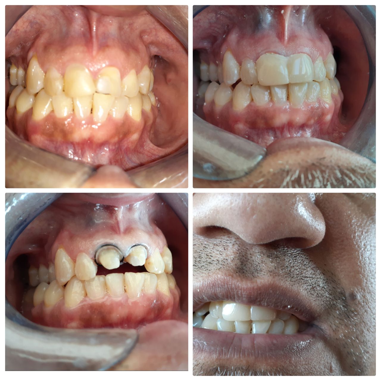 Laura Elizabeth Flores Alcaraz-5