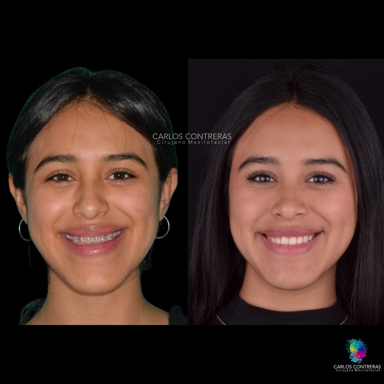 Carlos Ernesto Contreras Castellanos-7