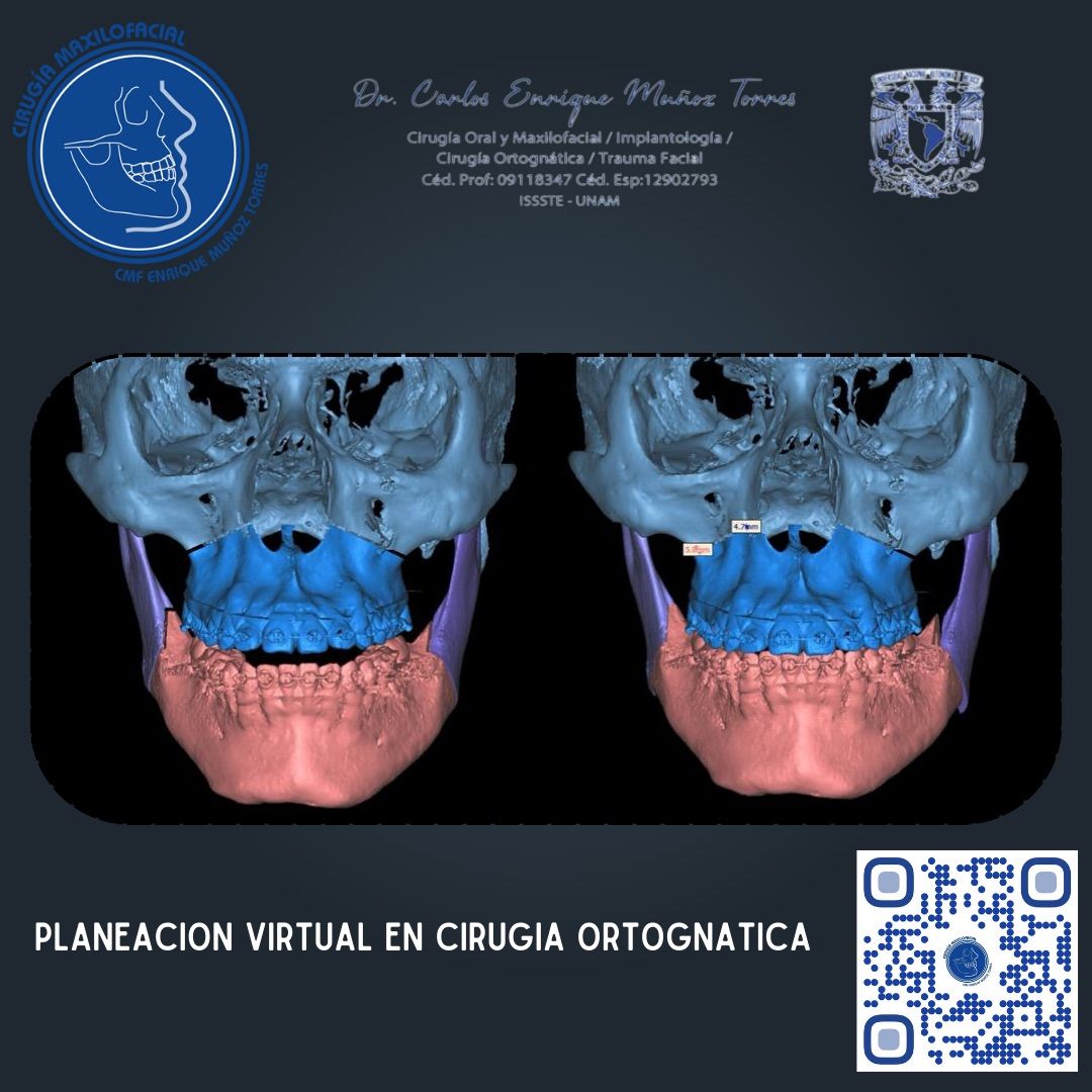 Carlos Enrique Muñoz Torres-14