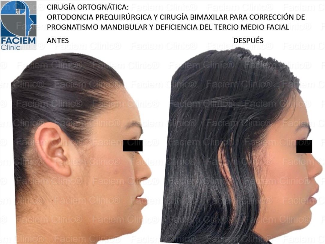 Ricardo Parra García-21