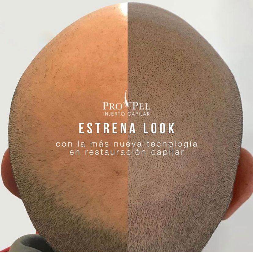 Karla Vanessa Becerra-28