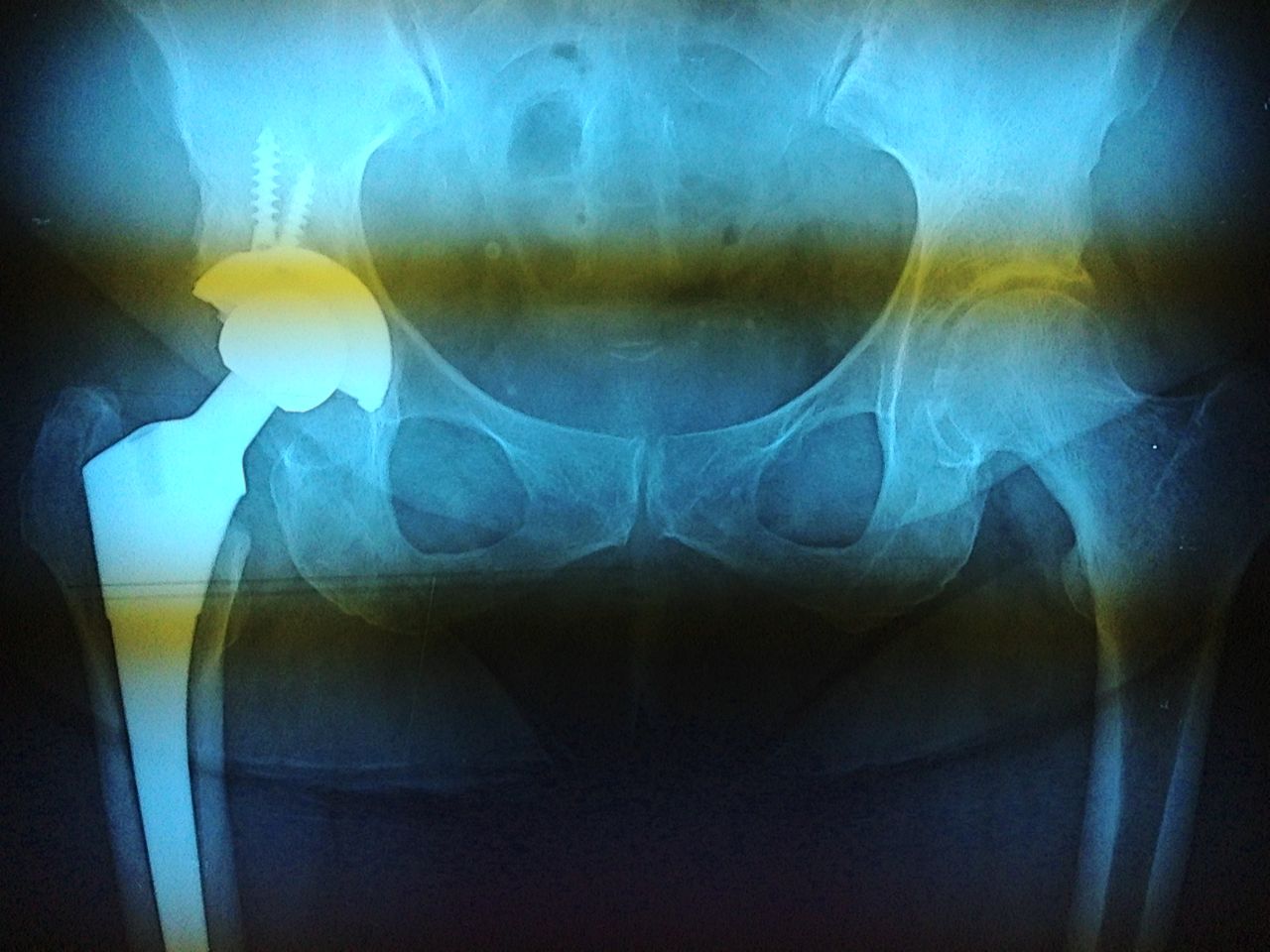 José Angel Salazar Granados-4