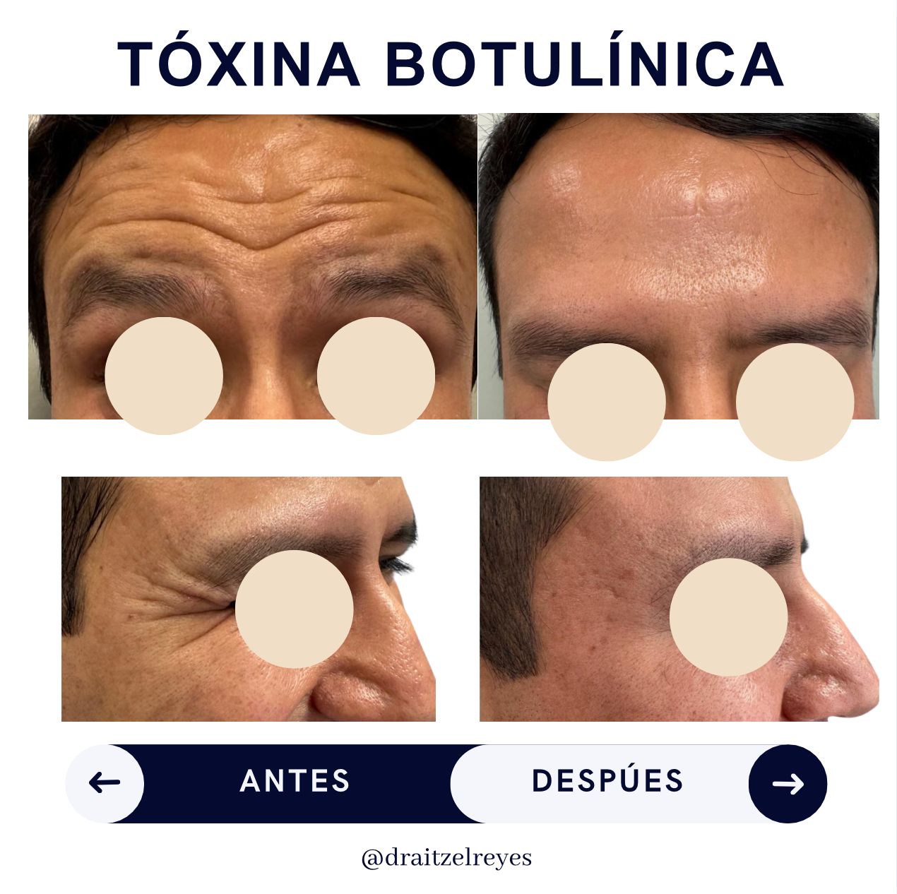 Itzel Anayn Flores Reyes-25