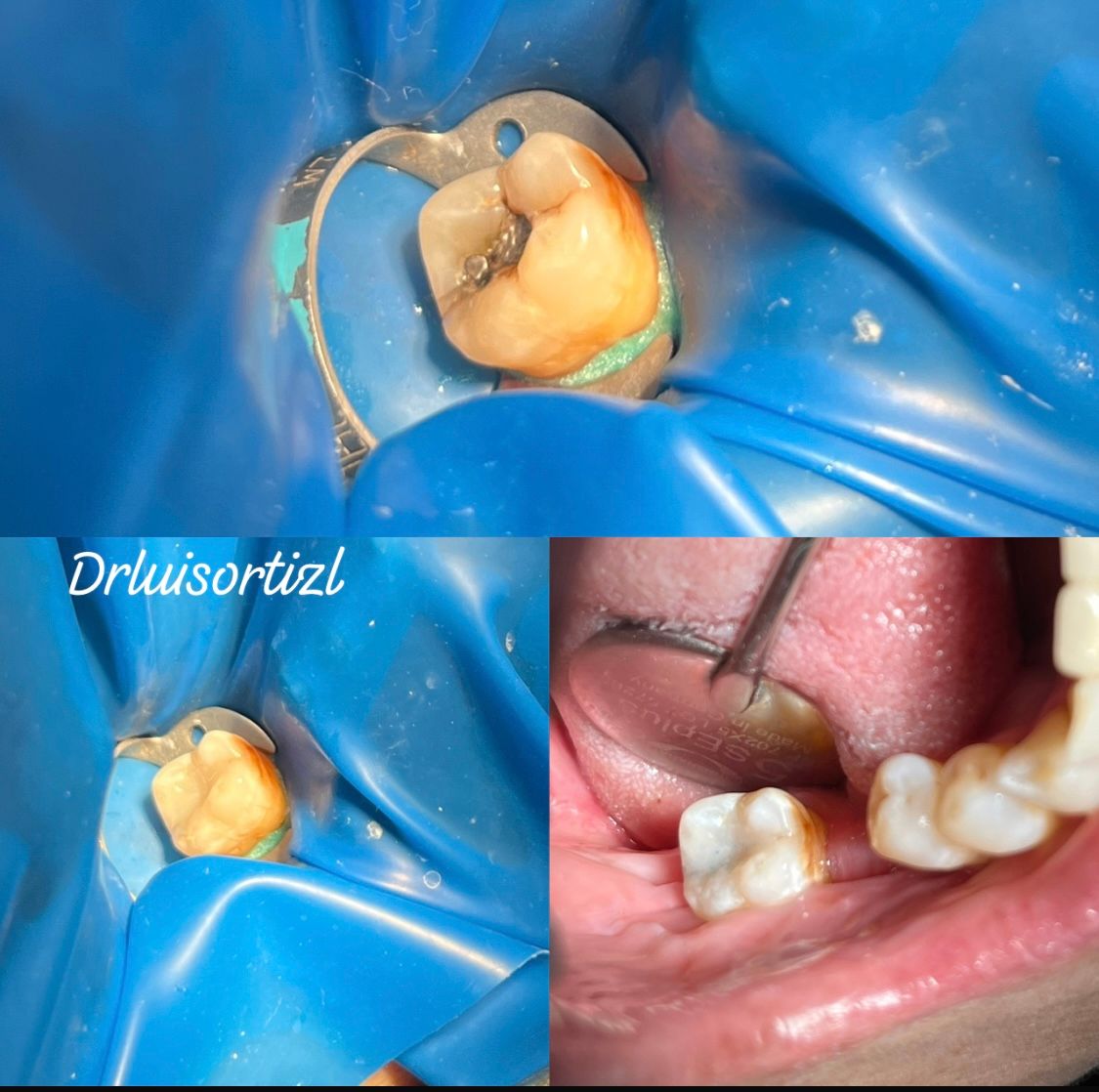 Luis Ángel Ortiz López-14