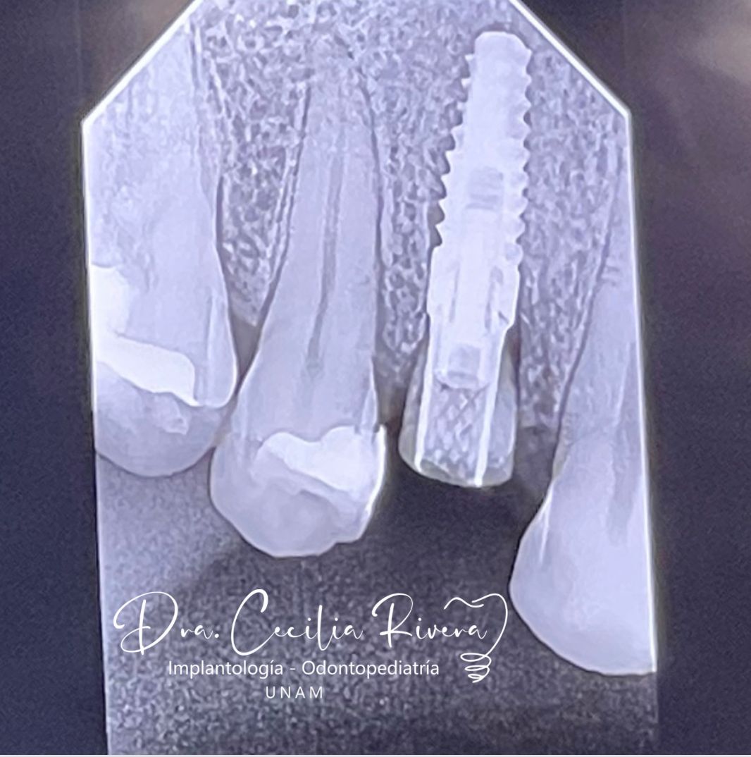 Cecilia Rivera Elizalde-29