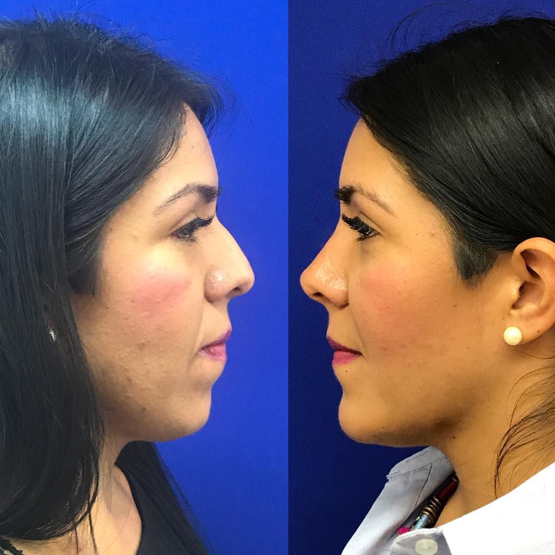 José Cortés Arreguin-19