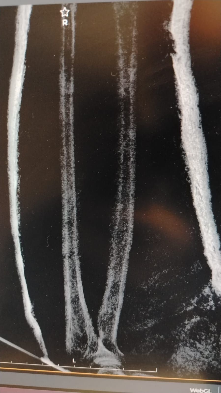 Alejandro Irisson-25