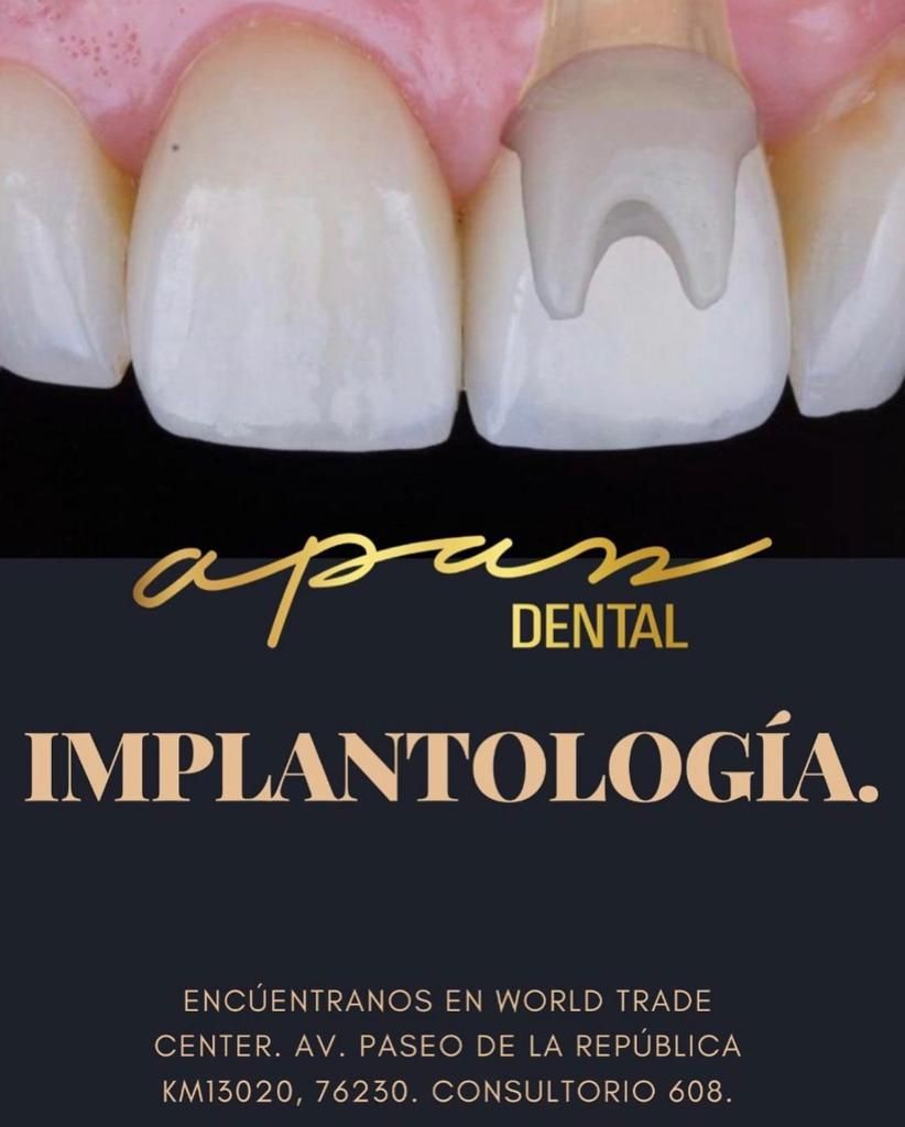 Zuleica Vera Apan-56