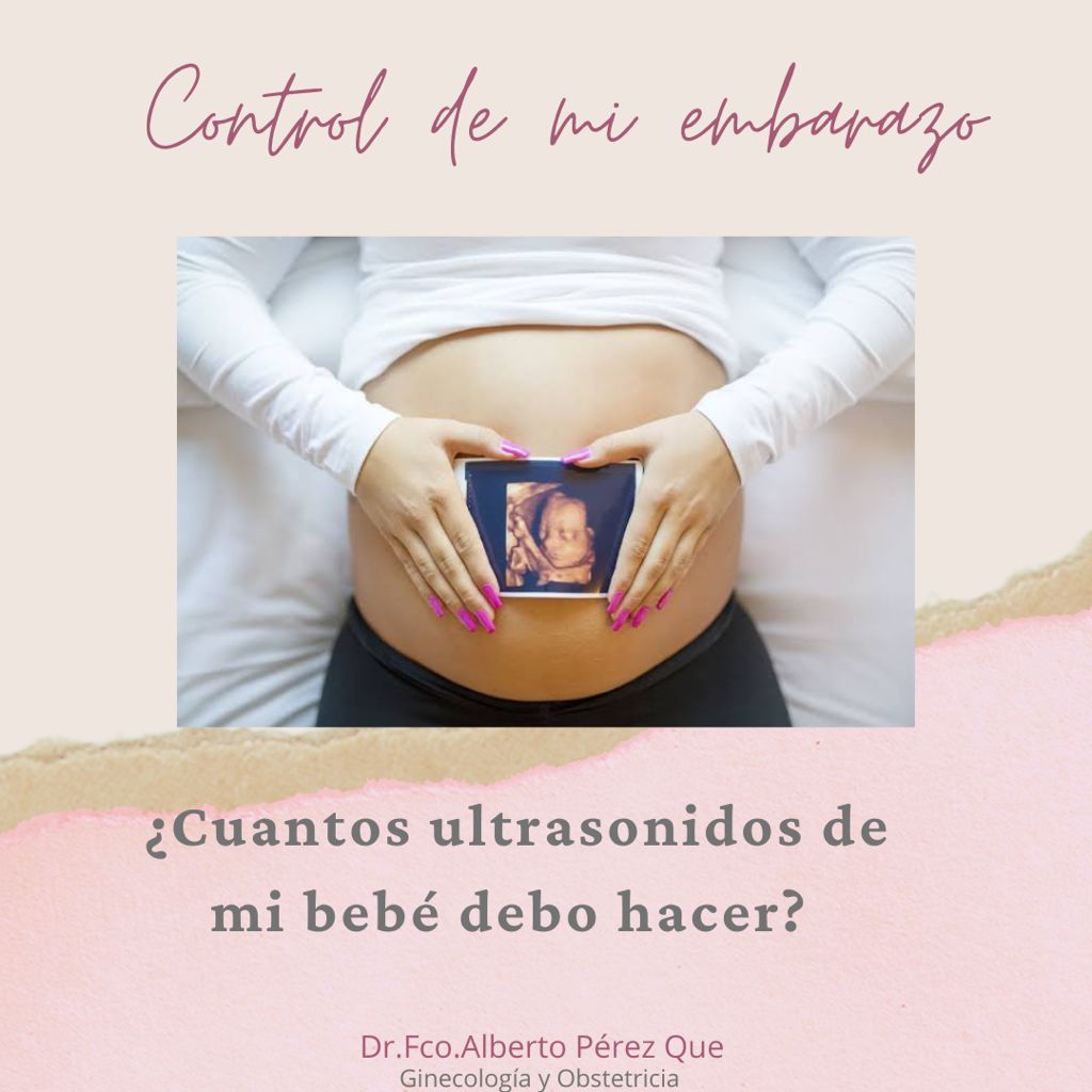 Francisco Alberto Perez Que-12