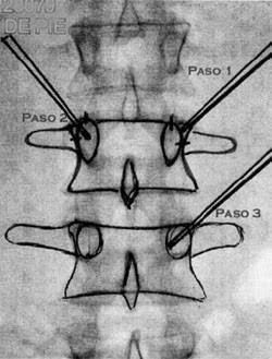 Rafael Maciel Morfin-6